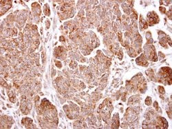 Invitrogen TMEM59 Polyclonal Antibody 100 &mu;L; Unconjugated:Antibodies,