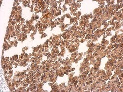 Invitrogen TMEM59 Polyclonal Antibody 100 &mu;L; Unconjugated:Antibodies,