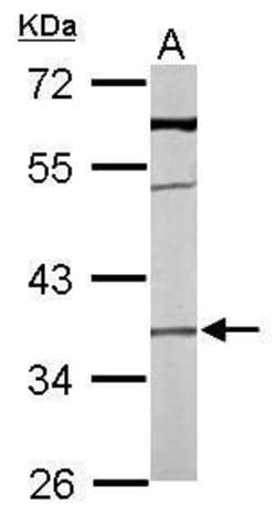 Invitrogen TMEM59 Polyclonal Antibody 100 &mu;L; Unconjugated:Antibodies,