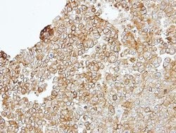 Invitrogen JAM2 Polyclonal Antibody 100 &mu;L; Unconjugated:Antibodies,