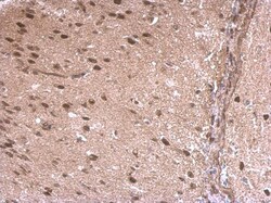 Invitrogen LDB1 Polyclonal Antibody 100 &mu;L; Unconjugated:Antibodies,