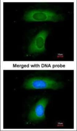 Invitrogen BLNK Polyclonal Antibody 100 &mu;L; Unconjugated:Antibodies,