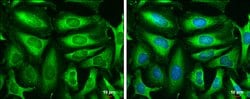 Invitrogen TPI1 Polyclonal Antibody 100 μL; Unconjugated:Antibodies,