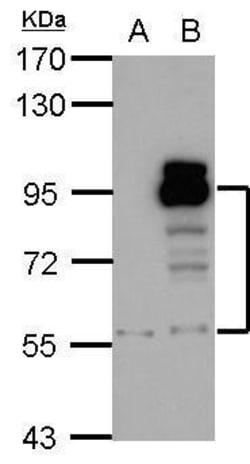 Invitrogen PDE4D Polyclonal Antibody 100 &mu;L; Unconjugated:Antibodies,