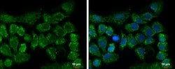 Invitrogen CLPP Polyclonal Antibody 100 &mu;L; Unconjugated:Antibodies,