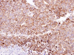 Invitrogen CLPP Polyclonal Antibody 100 &mu;L; Unconjugated:Antibodies,
