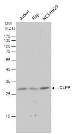 Invitrogen CLPP Polyclonal Antibody 100 &mu;L; Unconjugated:Antibodies,