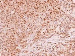 Invitrogen MAD2 Polyclonal Antibody 100 &mu;L; Unconjugated:Antibodies,