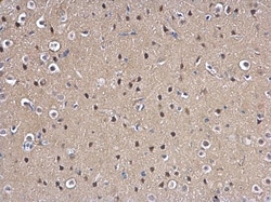 Invitrogen MAD2 Polyclonal Antibody 100 &mu;L; Unconjugated:Antibodies,
