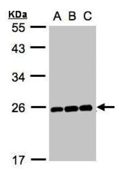 Invitrogen MAD2 Polyclonal Antibody 100 &mu;L; Unconjugated:Antibodies,