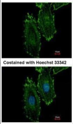 Invitrogen RASGRP4 Polyclonal Antibody 100 &mu;L; Unconjugated:Antibodies,