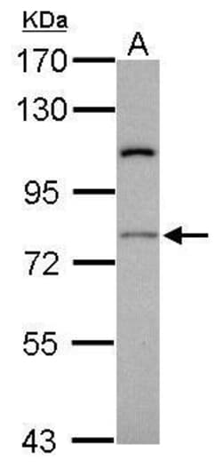 Invitrogen RASGRP4 Polyclonal Antibody 100 &mu;L; Unconjugated:Antibodies,