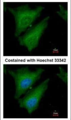 Invitrogen SOCS4 Polyclonal Antibody 100 &mu;L; Unconjugated:Antibodies,