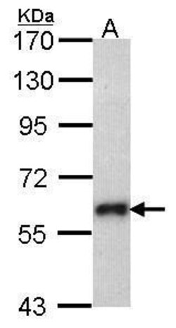 SOCS5 Polyclonal Antibody, Invitrogen 100 &mu;L; Unconjugated:Antibodies,
