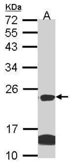 Invitrogen claudin 14 Polyclonal Antibody 100 μL; Unconjugated:Antibodies,