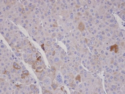 FBXO2 Polyclonal Antibody, Invitrogen 100 &mu;L; Unconjugated:Antibodies,