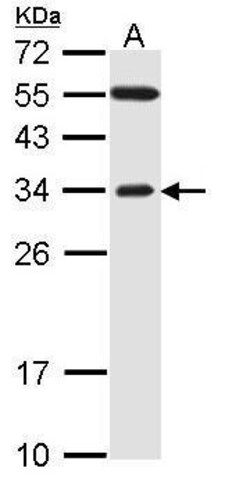 Invitrogen FBXO2 Polyclonal Antibody 100 &mu;L; Unconjugated:Antibodies,