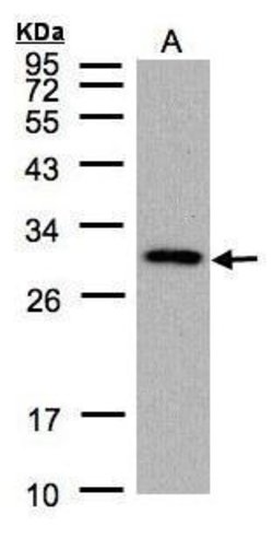 Invitrogen CTDSP2 Polyclonal Antibody 100 &mu;L; Unconjugated:Antibodies,