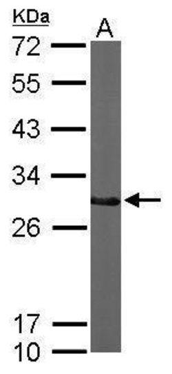Invitrogen CTDSP2 Polyclonal Antibody 100 &mu;L; Unconjugated:Antibodies,