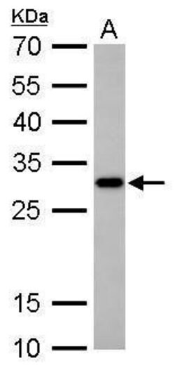 Invitrogen CTDSP2 Polyclonal Antibody 100 &mu;L; Unconjugated:Antibodies,