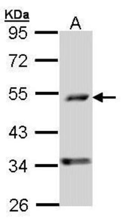 Invitrogen PDSS2 Polyclonal Antibody 100 &mu;L | Buy Online | Invitrogen&trade; | Fisher Scientific