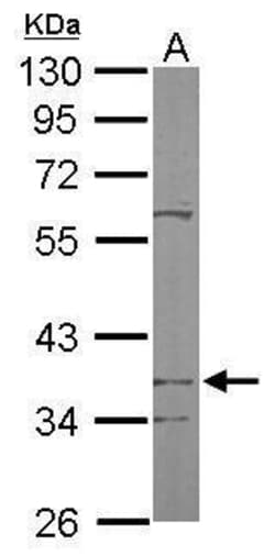 Invitrogen PDSS2 Polyclonal Antibody 100 &mu;L | Buy Online | Invitrogen&trade; | Fisher Scientific