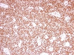 Invitrogen PRPF39 Polyclonal Antibody 100 &mu;L; Unconjugated:Antibodies,