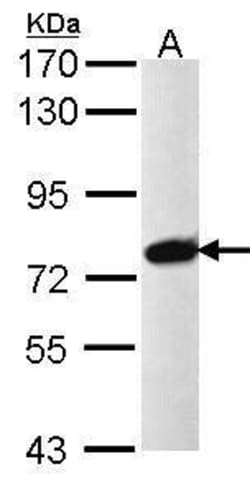 Invitrogen PRPF39 Polyclonal Antibody 100 &mu;L; Unconjugated:Antibodies,