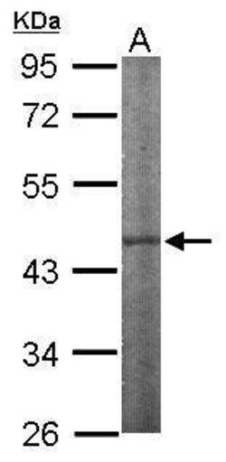 Invitrogen IPMK Polyclonal Antibody 100 &mu;L | Buy Online | Invitrogen&trade; | Fisher Scientific