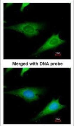 Invitrogen RPS3A Polyclonal Antibody 100 &mu;L; Unconjugated:Antibodies,