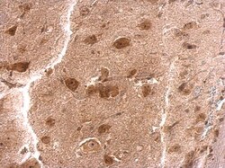 Invitrogen RPS3A Polyclonal Antibody 100 &mu;L; Unconjugated:Antibodies,