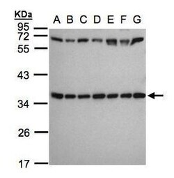 Invitrogen RPS3A Polyclonal Antibody 100 &mu;L; Unconjugated:Antibodies,