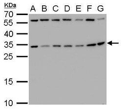 Invitrogen RPS3A Polyclonal Antibody 100 &mu;L; Unconjugated:Antibodies,