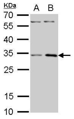 Invitrogen RPS3A Polyclonal Antibody 100 &mu;L; Unconjugated:Antibodies,