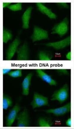 Invitrogen PSMA6 Polyclonal Antibody 100 μL; Unconjugated:Antibodies,