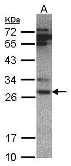 Invitrogen PSMA6 Polyclonal Antibody 100 μL; Unconjugated:Antibodies,