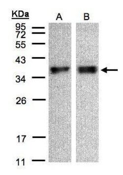 Invitrogen ZPBP Polyclonal Antibody 100 &mu;L; Unconjugated:Antibodies,