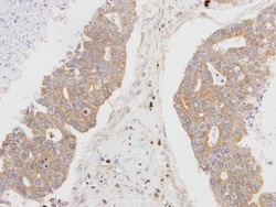 Invitrogen MSTO1 Polyclonal Antibody 100 &mu;L; Unconjugated:Antibodies,
