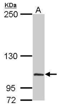Invitrogen DPP8 Polyclonal Antibody 100 &mu;L; Unconjugated:Antibodies,