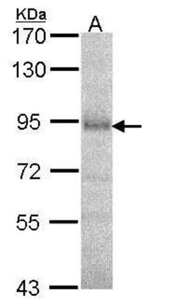 Invitrogen DPP8 Polyclonal Antibody 100 &mu;L; Unconjugated:Antibodies,