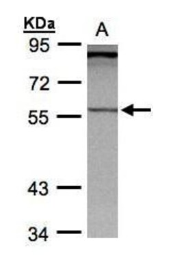 Invitrogen PCCB Polyclonal Antibody 100 &mu;L; Unconjugated:Antibodies,
