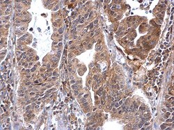 Invitrogen Annexin A7 Polyclonal Antibody 100 &mu;L; Unconjugated:Antibodies,
