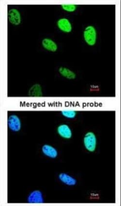 BRE Polyclonal Antibody:Antibodies, Polyclonal