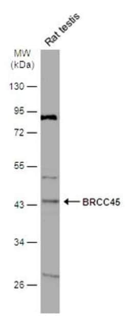 BRE Polyclonal Antibody:Antibodies, Polyclonal