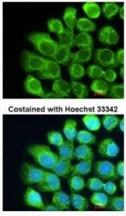 Invitrogen C2 Polyclonal Antibody 100 &mu;L; Unconjugated:Antibodies, Polyclonal