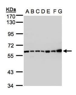 Invitrogen C2 Polyclonal Antibody 100 &mu;L; Unconjugated:Antibodies, Polyclonal