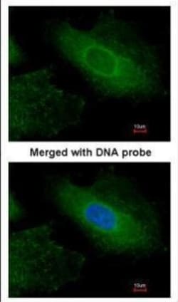 Invitrogen Radixin Polyclonal Antibody 100 &mu;L; Unconjugated:Antibodies,