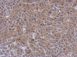 Invitrogen Radixin Polyclonal Antibody 100 &mu;L; Unconjugated:Antibodies,