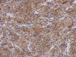 Invitrogen Radixin Polyclonal Antibody 100 &mu;L; Unconjugated:Antibodies,