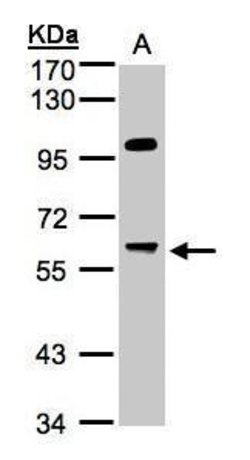Invitrogen PPP1R16A Polyclonal Antibody 100 &mu;L; Unconjugated:Antibodies,